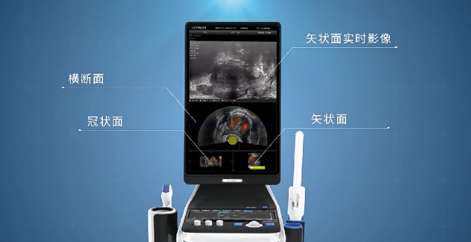 前列腺手術(shù)醫(yī)療設(shè)備產(chǎn)品三維動(dòng)畫(huà)視頻_三維動(dòng)畫(huà)案例-映畫(huà)傳媒